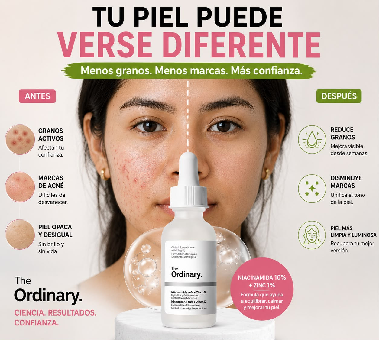 The Ordinary Niacinamide 10% + Zinc 1% ✨
