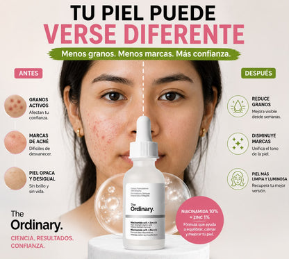 The Ordinary Niacinamide 10% + Zinc 1% ✨